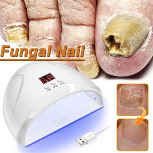 ツール真菌ネイルレーザーデバイストーネイル真菌除去高速修理爪真菌onychomycosis toenail fingern foot Care Cure Ingrow