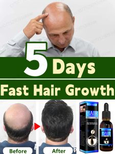 ケアヘア成長オイル、急速な成長、脱毛の効果的な修復、髪の頭の頭