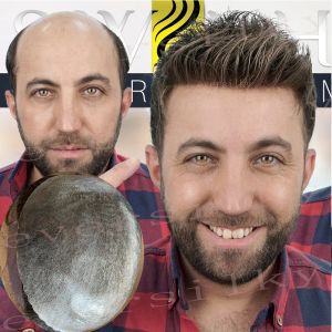 Toupees Natural Hairline Mens Microskin Toupee Brown Blonde Grey Black Human Hair Super Lover Comply Skin Pu -капиллярный протез