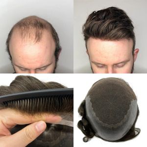 Toupees Indian Human Remy Hair Replacement System för män Toupee Mens Hairpieces Q6 BASE fransk spets med hud olika färg