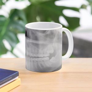 Canecas X-ray Vision Caneca de Café Copos de Cerâmica Conjunto Térmico Personalizado