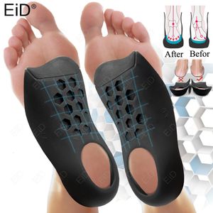 EiD Ortic Insoles for XOLegs Correction Orthopedic Flat Feet Heel Pain Arch Support For Man Woman Shoe Sole Insert 240321