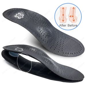 KOTLIKOFF Leather Orthotic Insole For Flat Feet Arch Support Orthopedic Shoes Sole Insoles For Feet Men Women O/X Leg Corrected