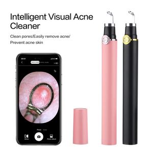 Wizualna szklanka do usuwania nosa czarna głowica Demontaż kropki pen Mini Camera Cleaning