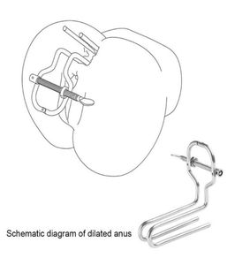 Brinquedos anal anal ajustável em aço inoxidável expansor de especulum vaginal bdsm escravo dilatador de dilatador enema sexo produtos208h2103728