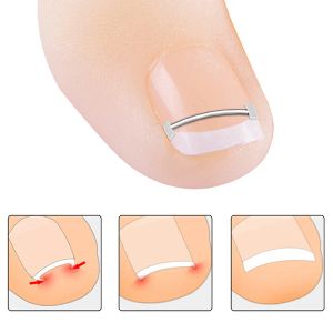 Ingrown Toenail Corrector Tools Pedicure Recover Emce Toe Nail Treatment Professional Ingrown Toenail Rätt ut klippverktyget