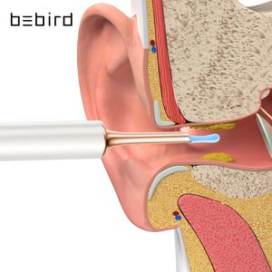 Bebird T15 R1 Очистка уха здравоохранения Minifit 2IN1 Инструмент по удалению угрей HD1080P Отоскоп IP67 Водонепроницаемый эндоскоп HD1080P IP67