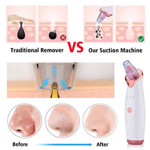 Blackhead Remover Pore Vacuum Face Cleaner Electric Pimple Black Head Removal Rechargeable Water Cycle Facial Nose Cleaning Tool