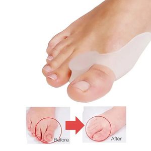 2PCS Silikonowy Koronek Koronkowy Koronek Mały stóp Separator Protektor Hallux Valgus Palce Propertener Opieka stopy Padsbunion Separator