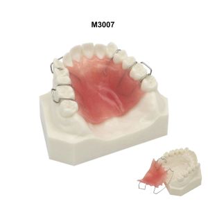 Dental Teaching Model Teeth Orthodontic model With Metal/ Ceramic Brackets Tube Chain Hawley Retainer For Dentist Patient Demo