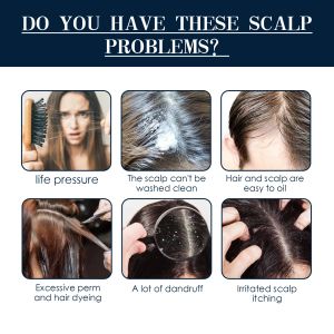 Scalp Treatment Essence Spray Cleansing Nourishing Anti Dandruff Itching Repair Prevent Hair Loss Smooth Hair Care for Men Women