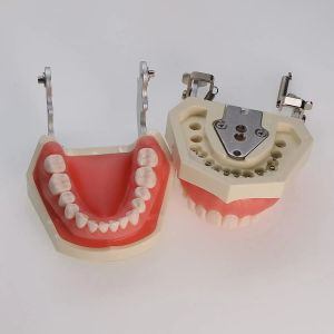 Denti typodont dentali Modello 28 denti rimovibili compatibili con Nissin Studio di insegnamento completamente staccabile, con un cacciavite