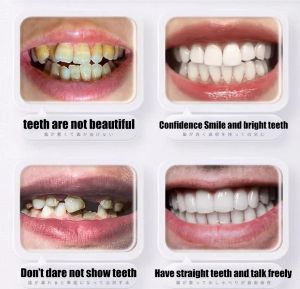 Sdotter Eco-friendly False Teeth Silicone Upper Lower smile Veneers Perfect Laugh Veneer Dentures Paste Fake Teeth Brace Tempora