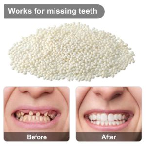 Resin10g/15g/20g Temporary Tooth Repair Kit Teeth And Gaps FalseTeeth Solid Glue Denture Adhesive Teeth Whitening Tooth Beauty