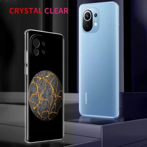 Genshin Impact -logotyp för POCO X5 X3 NFC F5 F4 F3 M3 Clear Phone Case för Xiaomi 12T 12 13 Lite 11 Ultra Mi 10T 5G 11X Pro Cover