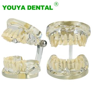 Modelo de dentes dentários infantis Modelo de modelo de tipo de diplomista normal Dentistista Ensino de ensino de ensino