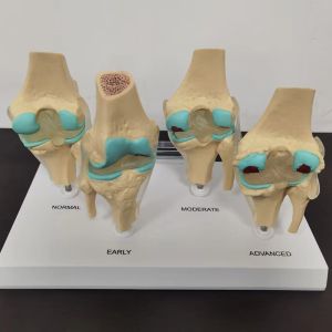 4-stegs knäledsmodellplast Benmodell för mänsklig kroppsundervisning Utrustning Studentlaboratorium för medicinsk undervisning PVC-modell