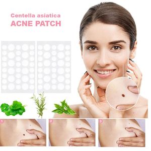 72pcs acne remendam