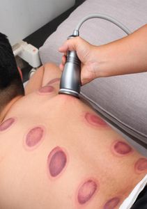 Gadget di fisioterapia a coppa a coppa meridiana massaggio per massaggio per corpi di aspirazione barattoli muscolari rilassati elettrici cala sha aspirapo