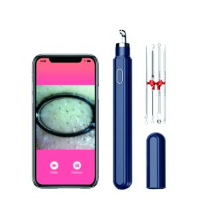 Steuerung Miredor Smart Visual Blackhead Remover mit HD -Kamera, App Control WiFi sichtbare Akne -Entfernungsnadel für ISO -Andorid -Telefon