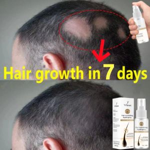 Шампуоконтрольщик имбирный рост волос. Сывороточная спрей для мужчин, которые женщины способствуют корню, быстро растут