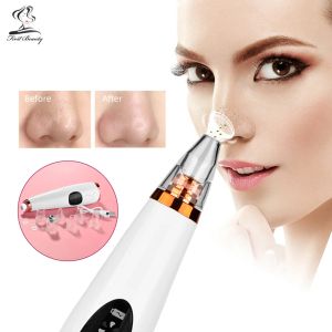 Scrubbers Electric Facial Blackhead Remover Vacuum Pore Cleaner Nose Face Deep Cleansing Skin Removal Acne Pimple Care Hine Beauty Tool