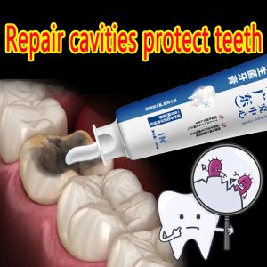 Kits 100g Repair of Cavities Caries Repair Teeth Teeth Whitening Removal of Plaque Stains Decay Whitening Yellowing 2023 New