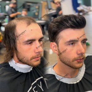 Toupees 1b20 cabelos grisalhos de penteado masculino lotes de penteado masculino de peles natural não detectada Base capilar Sistema de substituição de cabelo capilar