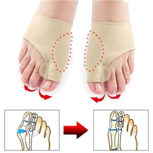 Behandling 1Pair Toe Separator Hallux Valgus Bunion Corrector Hammer Toe Straceer Foot Pain Relief Orthopedic Pedicure Tools Foot Care