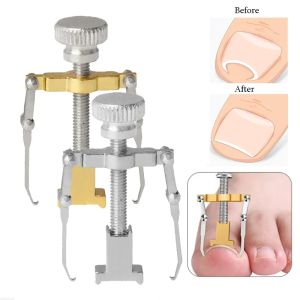 Tool Straightening Clip Ingrown Toenail Corrector Pedicure Foot Nail Care Tools Stainless Steel Pedicure Treatment Onyxis Correction