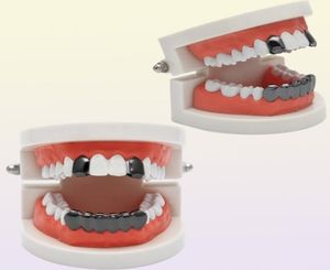 Uwin hip hop rosa cor personalizada billz grillz de 2pcs tops singl top 6 dentes inferior conjunto de ouro grades9483772