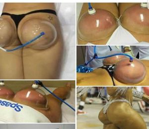 2 Dosen Brust -Gesäß -Verbesserungspumpe für Lady Vakuum Gupting Body Massager -Verbesserung des Schröpfens Therapie Gerät2394133