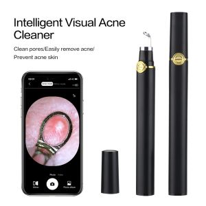 Scrubbers Smart Visual Acne Cleaner Blackhead Remover Acne Needle Cleansing Pore Squeeze Tool Cosmetic Device Facial Treatment with Camera