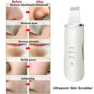 Scrubber Scrubber per la pelle ad ultrasuoni Vibrazione Spatola per il viso Rimozione di comedone Acne Pala Cavitazione pulita Peeling Lifting del viso Cura della pelle