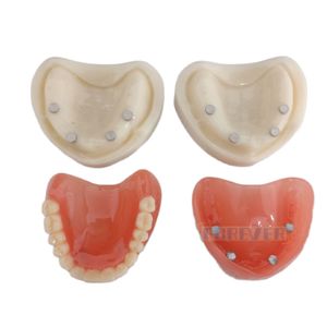 Other Oral Hygiene Dental Model Full Denture Magnetic UpperLower Attachment Study Mandibular 230919