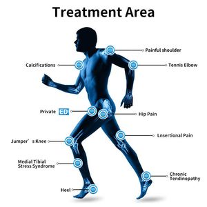 Máquina de tratamento de terapia em onda de choque em emagrecimento em emagrecimento EMS Custo de radiofrequência de RF que funciona 3 em 1 MASSAGER DO MASSAGER Equipamento de alívio doloroso