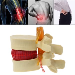 Other Office School Supplies Lumbar Vertebrae Model Anatomical Spine Disc Herniation Anatomy Teaching Tool 230130