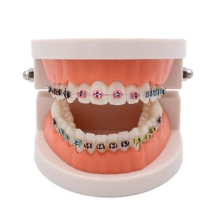 Altro Igiene orale Un modello ortodontico per lo studio dell'insegnamento dell'ortodonzia Modelli ortodontici per l'odontoiatria medica Igiene orale e prodotti dentali 230802