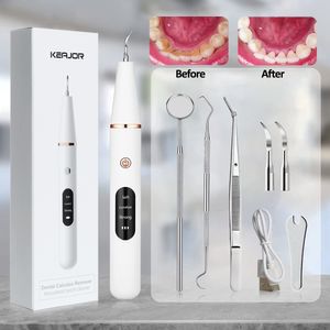 Outra higiene oral G6 Ultrasonic Dental Cálculo Removedor Dentes Placa Tártaro Eliminador Manchas Limpador Elétrico Dente Pedra 230824