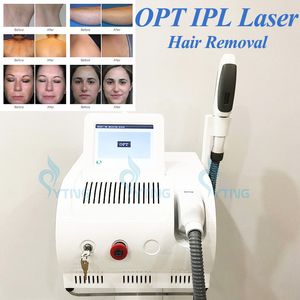 آلة إزالة الشعر بالليزر IPL شعبية E الضوء الدائم مزيل الشعر التردد الراديوي لرفع الجلد تجديد شباب علاج أصباغ