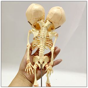 Dekorativa föremål Figurer 37 cm Human Double Head Baby Skull Skeleton Anatomy Brain Display Study Undervisning Anatomisk modell Halloween Bar Ornament 230508