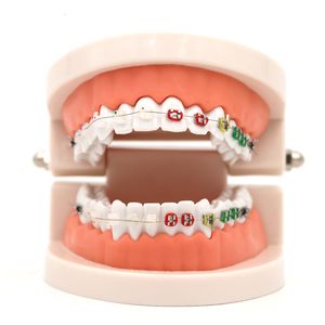 Andere Mundhygiene 1pc Dental Kieferorthopädische Behandlung Modell mit Ortho Metall Keramik Halterung Bogendraht Bukkalröhrchen Ligatur Krawatten Dental Werkzeuge 230524