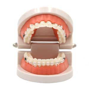 Orto Metal Seramik Braket Kemeri ile diğer Oral Hijyen Dental Ortodontik Tedavi Modeli Tel Bukkal Tüp Ligatürü Diş Araçları Diş Hekimi Laboratuvarı 230524