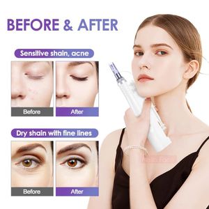 Wirless Derma Microneedle Pen with LED 5 Speed ​​Auto Microneedling MTS Mesoterapi Skin Care Dermapen Micro Cartridge Anti Pore Skin Repair Nutrition Input