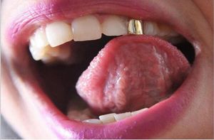 Grelhas dentárias de dentes dourados, grelhas dentárias para homens de alta qualidade, ouro rosa, preto, moda hip hop, joias 1322392
