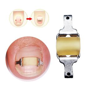 Foot Care Ingrown Toenail Corrector Tools Pedicure Professional Correction Tool Recover Embed Toe Nail Treatment 231216