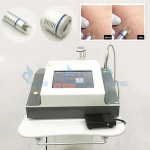 Sprzęt 980 nm Diode Laser Usuwanie naczyniowe Inne wyposażenie kosmetyczne Czerwone naczynia krwionośne żyły pająka