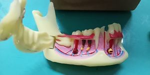 Andra orala hygiener Dental Endodontic Treatment Model Anatomy of Goms Dental Study Lär tänder Modell 230720