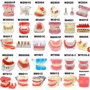 Outros dentes dentais de higiene oral modelo de ensino modelos de implantes modelo de dentes removíveis para odontologia para treinamento estudando educação do paciente 230720