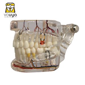 Outros dentes de higiene oral Reparo neural Implante dental Modelo patológico Dentista estudantes Comunicação Aprendizagem Pesquisa do ensino de doenças 230417